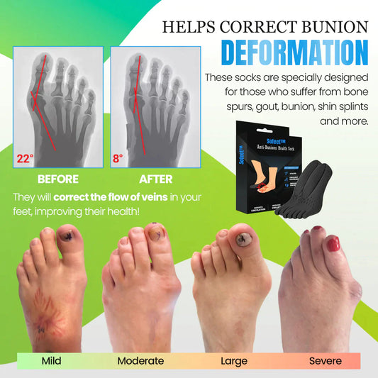 Sofeet™ Anti-Bunions Health Socks